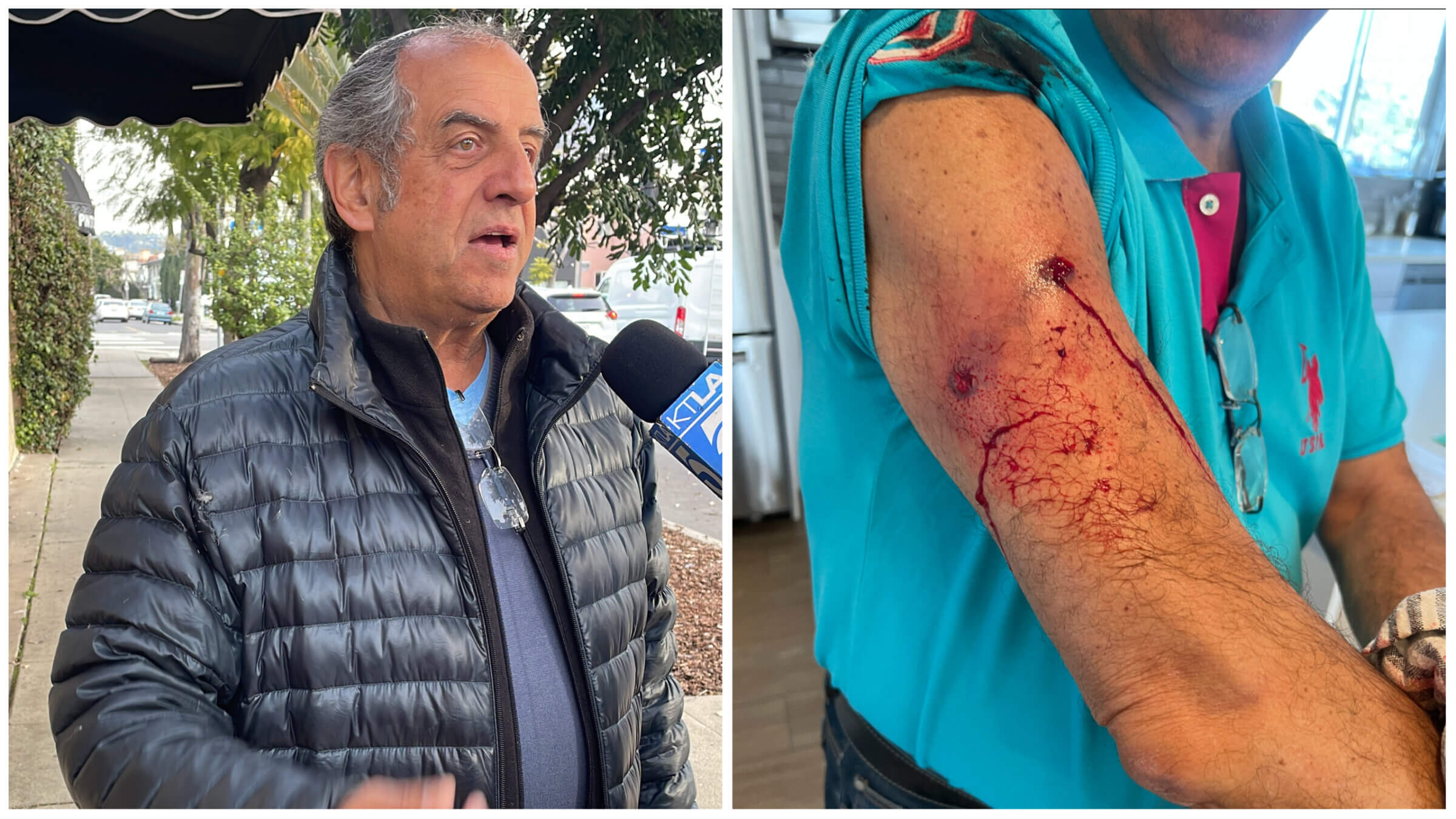 Left: Guy Taieb, 73, outside the Pinto Center Friday morning. At right, his wounds from Thursday morning, when he was shot walking home from services.