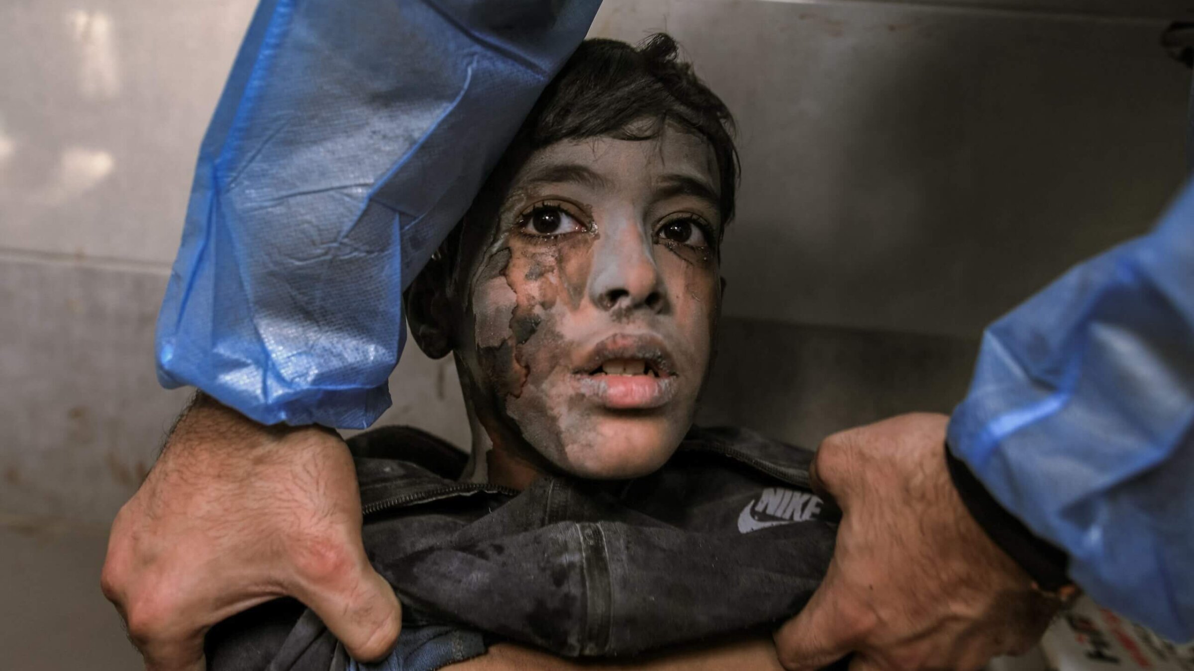 A young boy undergoes a medical examination by a doctor at the overcrowded Al-Shifa Hospital in Gaza City following an Israeli airstrike, Oct. 18, 2023.