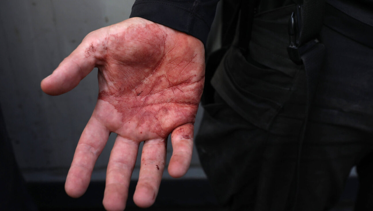 A colleague of Aysenur Eygi, an American-Turkish activist who died after reportedly being shot in the West Bank town of Beita, shows his blood-stained hand at a hospital in Nablus, West Bank, Sept. 6, 2024