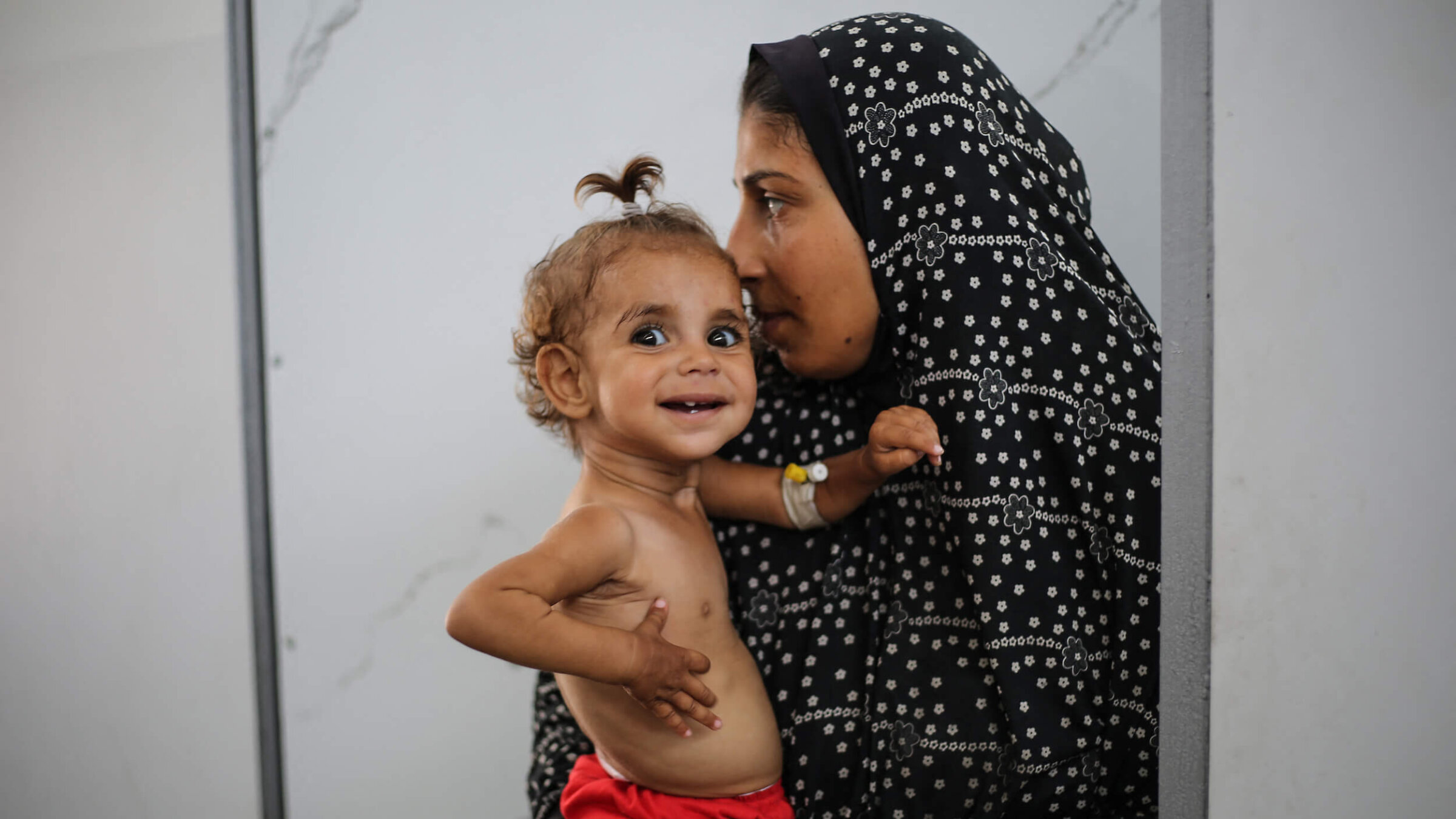 A Palestinian woman holds a malnourished child at Al-Awda hospital in the Nuseirat refugee camp in the central Gaza Strip on June 30.