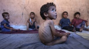 Yazan, a malnourished 2-year-old Palestinian boy, sit with his brothers at their family’s damaged home in the Al-Shati refugee camp, west of Gaza City, on July 23, 2025. 