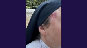 A nun sustained a head injury on April 28, 2026 after a man allegedly attacked her in the Old City of Jerusalem. (Screenshot/Israeli Police)