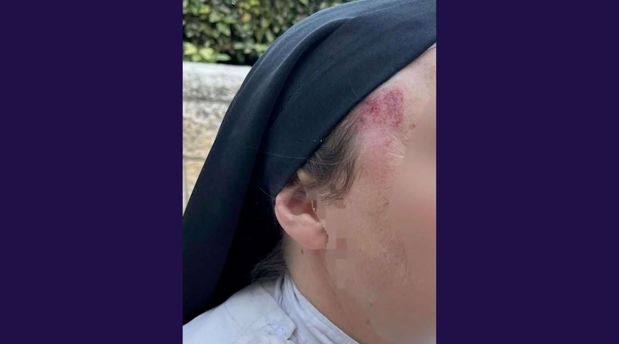 A nun sustained a head injury on April 28, 2026 after a man allegedly attacked her in the Old City of Jerusalem. (Screenshot/Israeli Police)